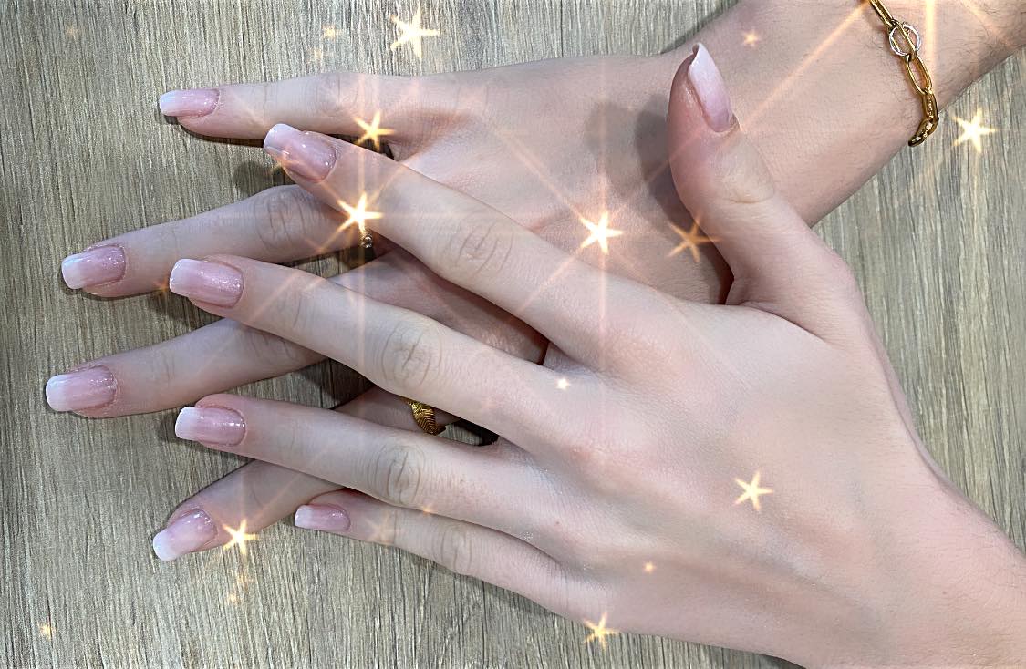 Vernis